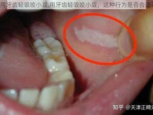 用牙齿轻吸咬小豆,用牙齿轻吸咬小豆，这种行为是否合适？