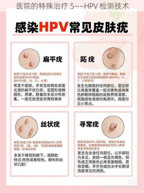 医院的特殊治疗 5——HPV 检测技术